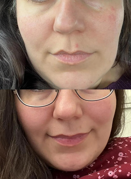 Testimonio de Lizeth Alvarez