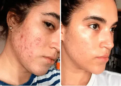 Testimonio de Lorena Vargas