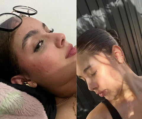 Testimonio de Laura Restrepo