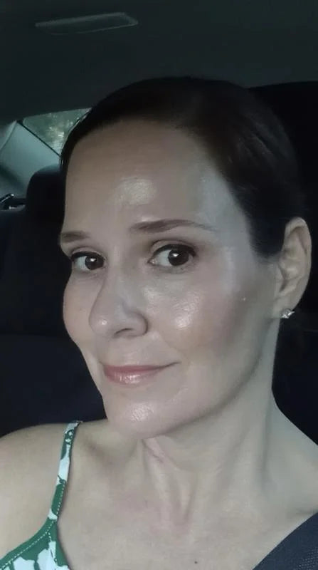 Testimonio de Lizeth Alvarez